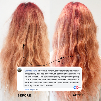 Hair Growth Oil For Hair Loss
